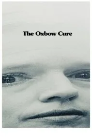 درمان آکسبو (The Oxbow Cure)