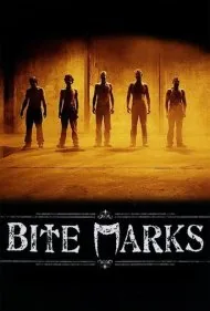 آثار گاز گرفتگی (Bite Marks)