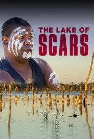 دریاچه زخم‌ها (The Lake of Scars)