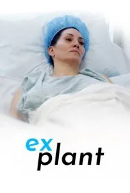 اکسپلنت (Explant)