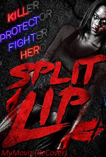 لب شکری (Split Lip)