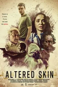 پوست تغییر یافته (Altered Skin)
