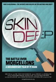 تا عمق پوست: نبرد بر سر مورجلون (Skin Deep: The Battle Over Morgellons)