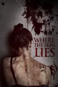 جایی که پوست دروغ میگوید (Where the Skin Lies)