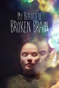 مغز زیبای آسیب‌دیده من (My Beautiful Broken Brain)